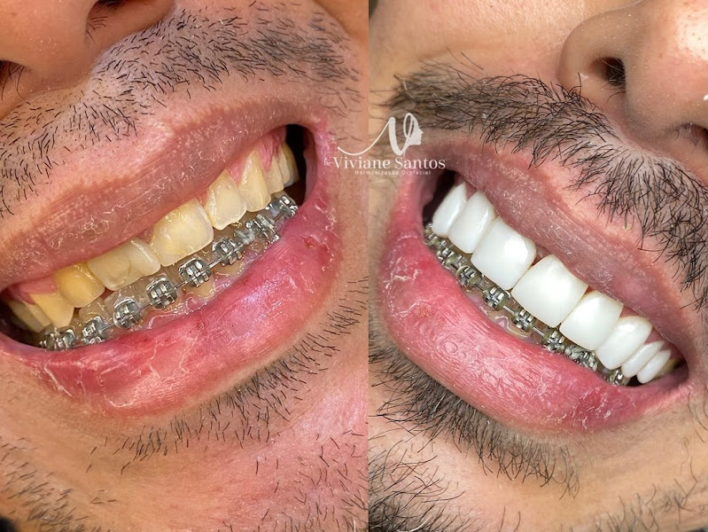 Foto 3 de Dentista Rio de Janeiro | Clínica Odontológica Rio Smile