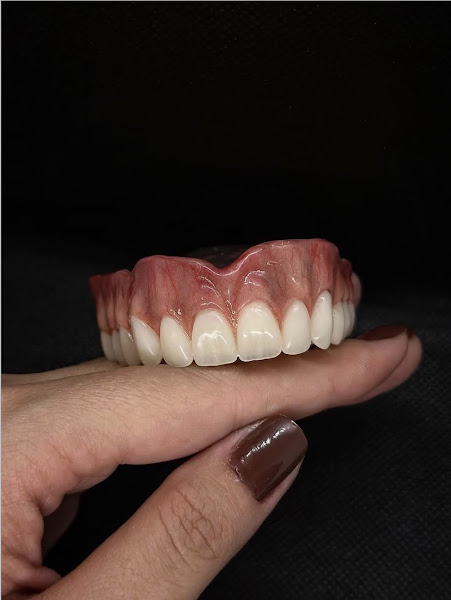 Foto 3 de Dentista Santa Cruz - Dra Fernanda Leite /Clareamento dental /Prótese dentária /Aparelho Ortodôntico/Lente em resina