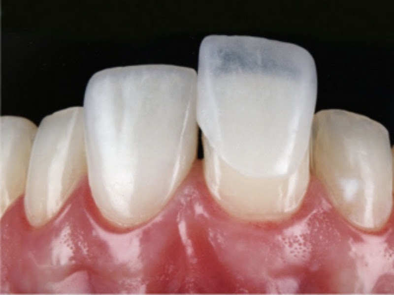 Foto 9 de Dentista Santa Cruz - Dra Karolyne M. Duque