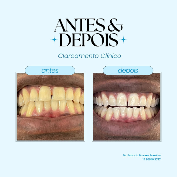 Foto 3 de Dentista (Santo André) Dr. Fabricio de Moraes Frankiw