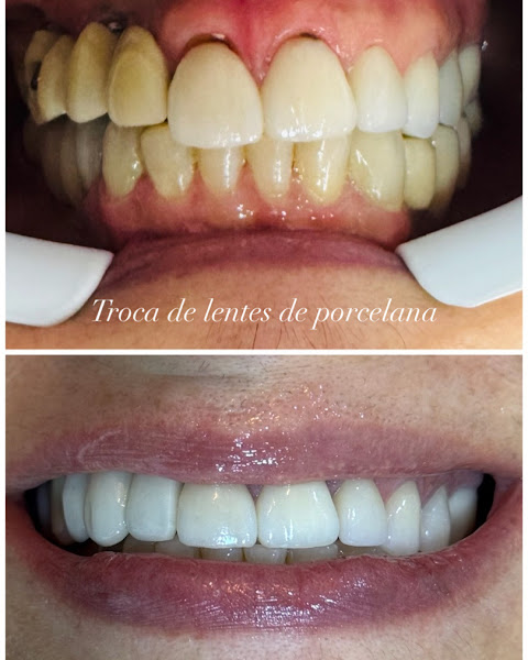 Foto 2 de Dentista São Paulo | Dra. Márcia Costa Cedro – Bom Retiro