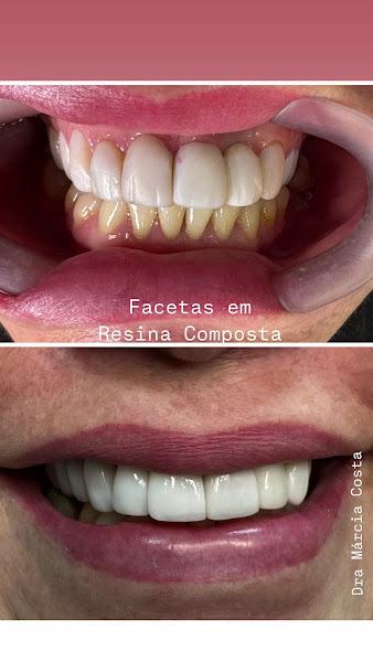 Foto 4 de Dentista São Paulo | Dra. Márcia Costa Cedro – Bom Retiro