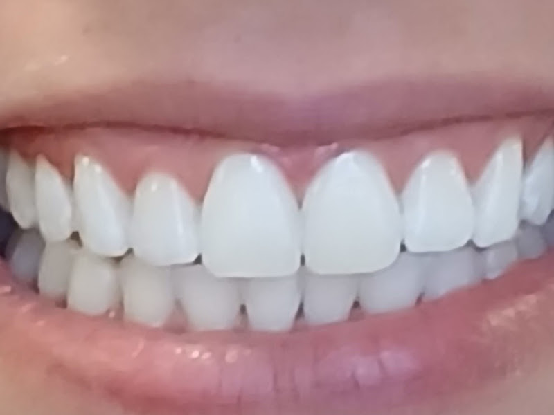 Foto 8 de Dentista São Paulo | Dra. Márcia Costa Cedro – Bom Retiro