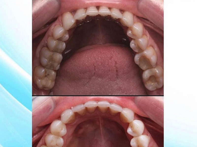 Foto 9 de Dentista São Paulo | Dra. Márcia Costa Cedro – Bom Retiro