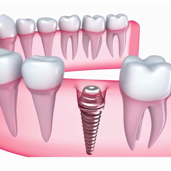 Foto 3 de Dentista SBC, Implante Dentário, Lentes de Contato Dental | Dentista em São Bernardo do Campo, Clínica Odontológica em SBC