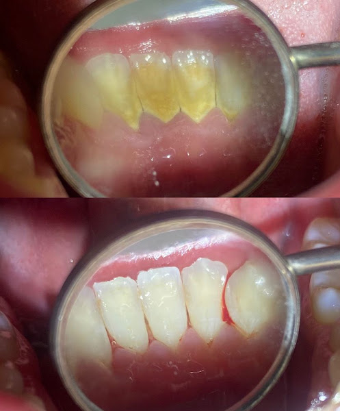 Foto 2 de Dentista SJC - Dra Fabiana Vinhas