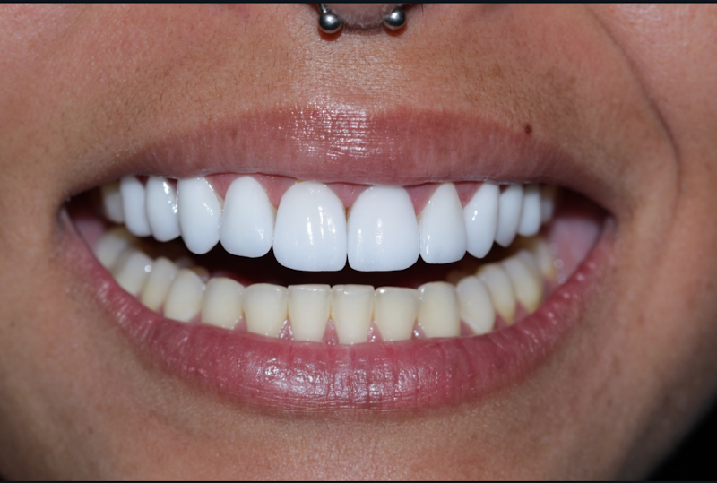 Foto 2 de Dentista Sorria Mais Plataforma | Extração | Canal | Implantes | Prótese | Aparelho Ortodôntico | Subúrbio | Suburbana