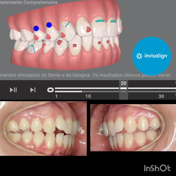 Foto 3 de Dentista Sorria Mais Plataforma | Extração | Canal | Implantes | Prótese | Aparelho Ortodôntico | Subúrbio | Suburbana