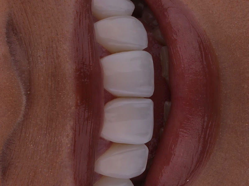 Foto 3 de Dentista Sorrir Saúde - Espaço odontológico