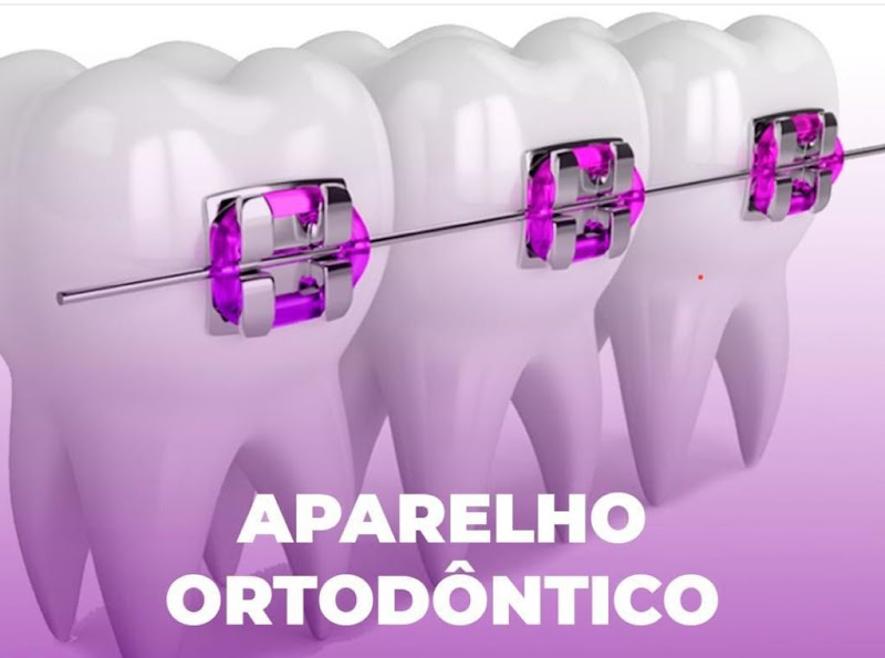 Foto 3 de Dentista Sorriso Belo varjota