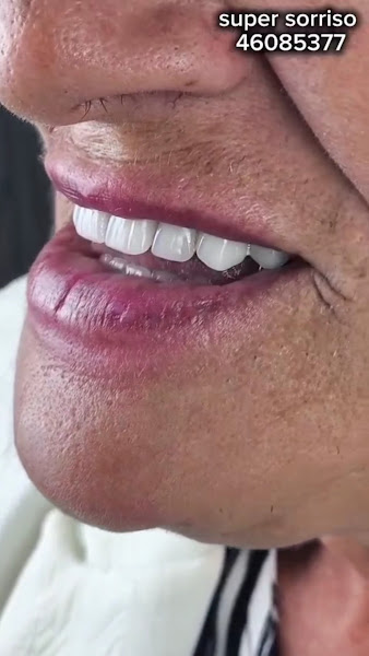 Foto 2 de Dentista Super Sorriso