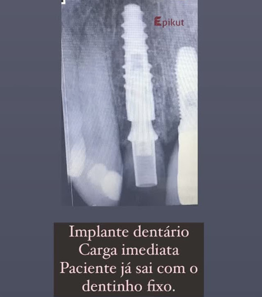 Foto 2 de Dentista Taiana Alves Palhoça | Clinica Aura Palhoça