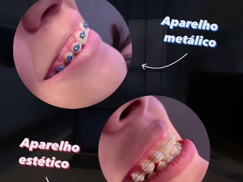 Foto 7 de Dentista Tânia Rocha | Endodontia em Natal, RN