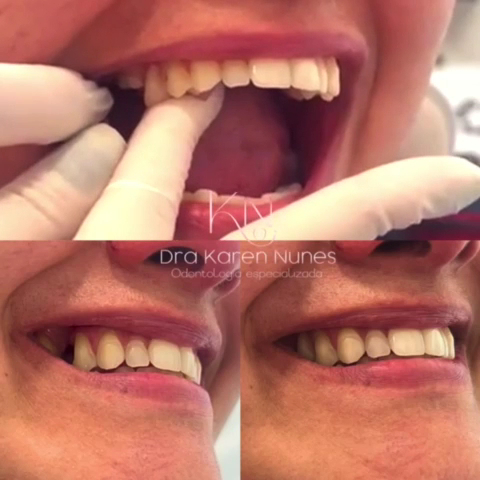 Foto 4 de Dentista Taquara - Dra. Karen Nunes, Endodontista. Atendimento Humanizado e Especializado em Todas as Áreas da Odontologia.