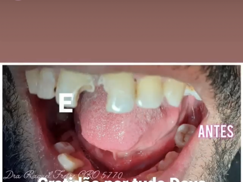 Foto 2 de Dentista Tarumã, 195, Sorriibem.