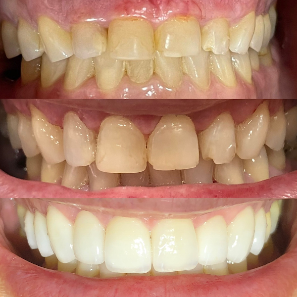 Foto 2 de Dentista Tatuapé - Dra Monique Cascapera