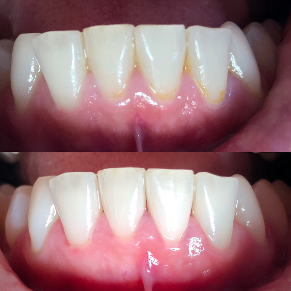 Foto 3 de Dentista Tatuapé - Dra Monique Cascapera