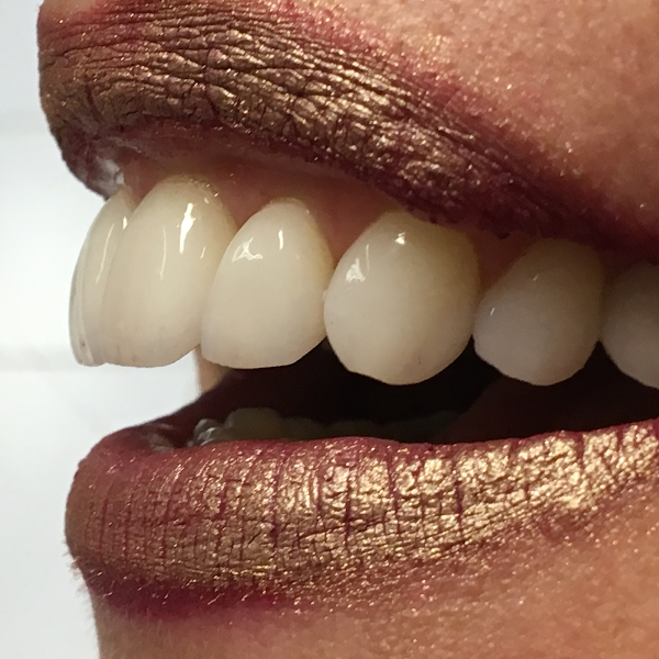 Foto 4 de Dentista Tatuapé - Dra Monique Cascapera