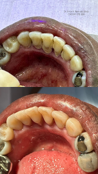 Foto 3 de Dentista Taubaté -Dr. Erick Reis - Consultório Odontológico
