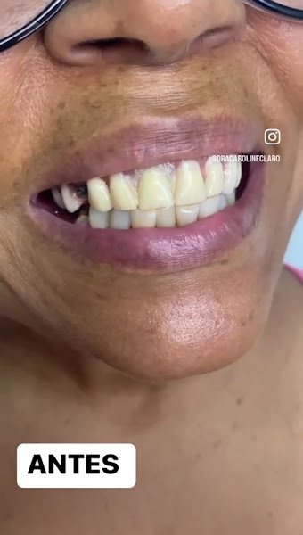 Foto 3 de Dentista Taubaté - Giacomini Odontologia