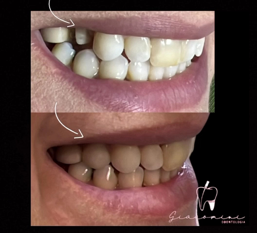 Foto 4 de Dentista Taubaté - Giacomini Odontologia