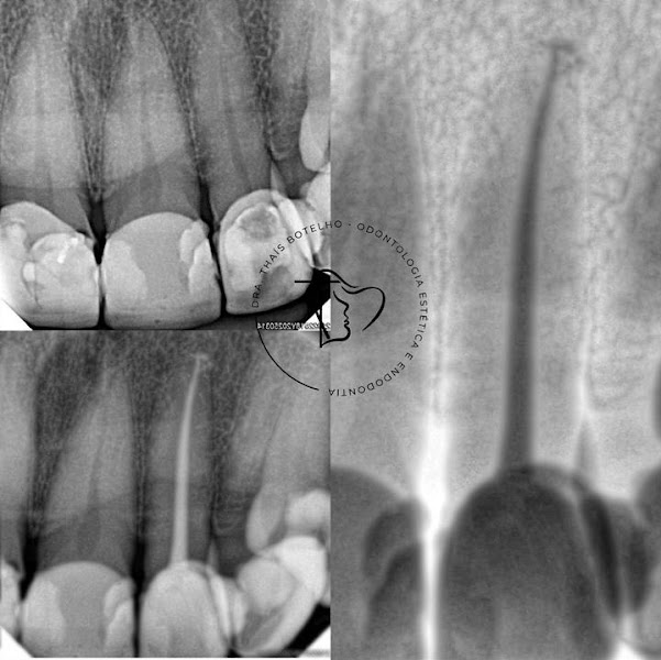 Foto 3 de Dentista Thaís Botelho - ENDODONTISTA