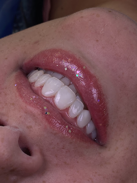 Foto 2 de Dentista Thayná Feijó
