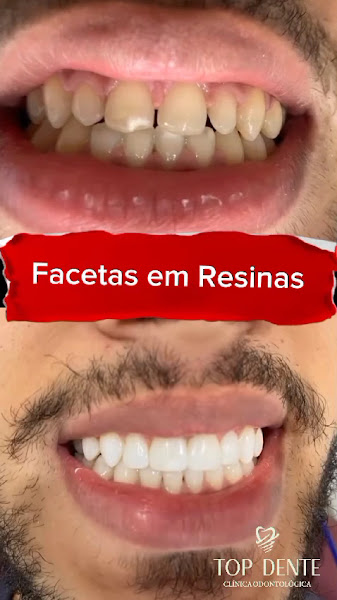 Foto 2 de Dentista Top Dente Clínica odontologia