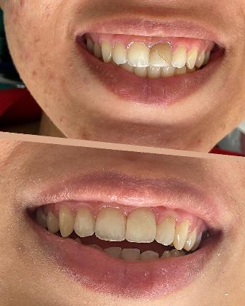 Foto 3 de Dentista Top Dente Clínica odontologia