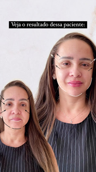 Foto 2 de Dentista Vanessa Mazza - Consultório Dentário - Harmonização Facial - Odontoeva