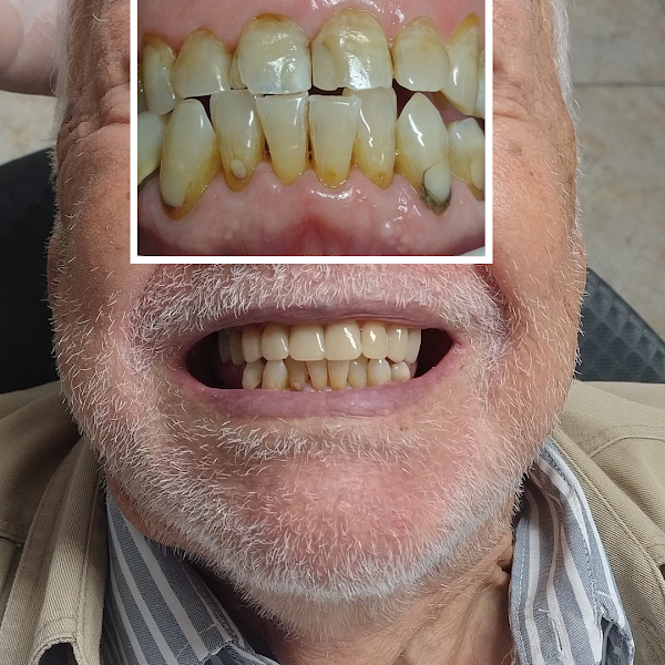 Foto 3 de DENTISTA (VENDRAME ODONTOLOGIA ESPECIALIZADA) -Dra. Michele Vendrame