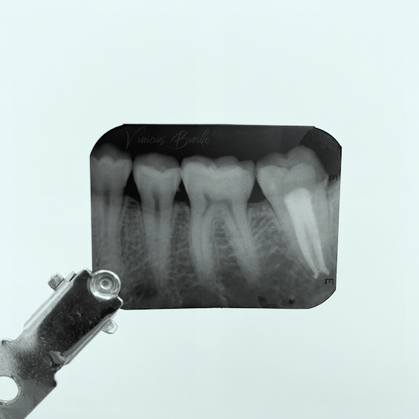 Foto 2 de Dentista Vinícius Burille - Santa Cruz do Sul