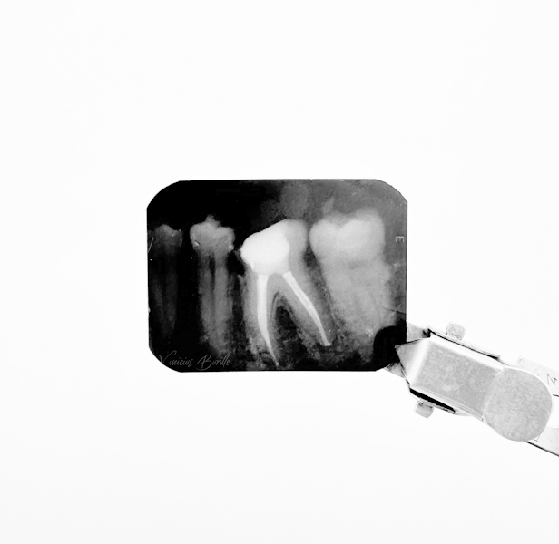 Foto 3 de Dentista Vinícius Burille - Santa Cruz do Sul