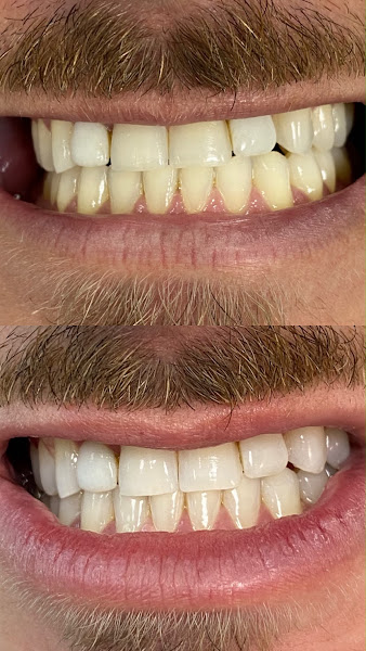 Foto 2 de Dentista Vitória da Conquista Filipe Lins