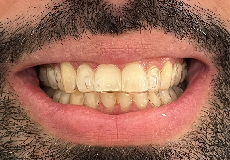 Foto 3 de Dentista Vitória da Conquista Filipe Lins