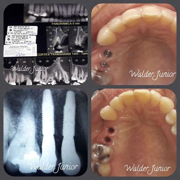 Foto 2 de Dentista Walder Offredi Jr Magé