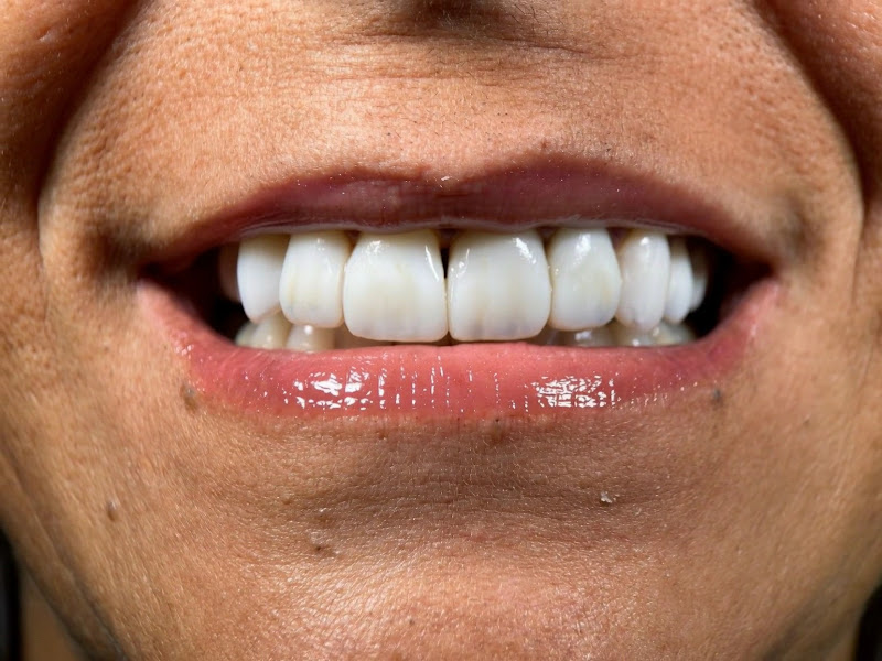 Foto 3 de Dentista Willian Silveira