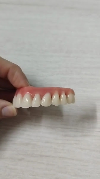 Foto 4 de Dentista Zona Leste | Siso | Implante Dentario | Protese Protocolo | OdontoGama | Protese Dentaria | Conserto de Dentadura