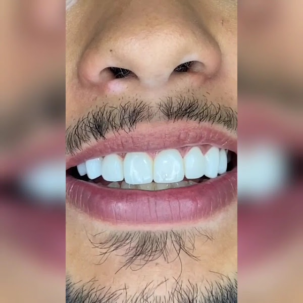 Foto 3 de DENTISTAS CONSTRUINDO SORRISOS VIDIGAL