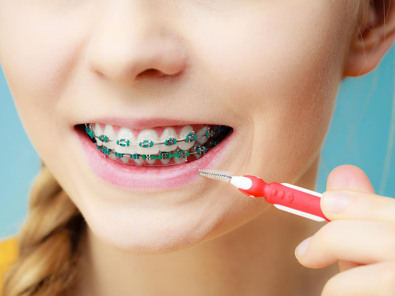 Foto 5 de Dentistas do Sul - Unidade Manoa