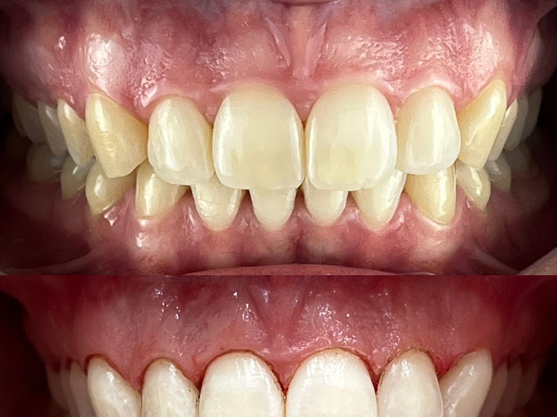 Foto 3 de Dentistas Dr.Leonardi Lima