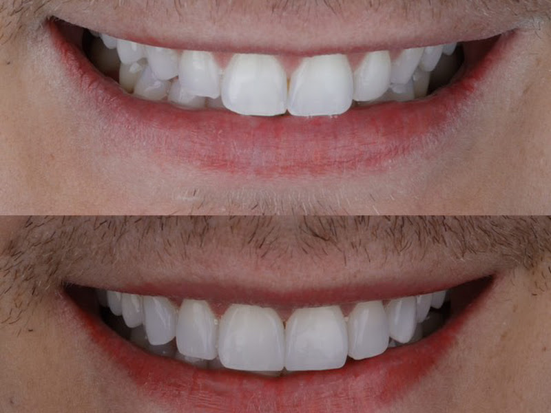 Foto 2 de DENTISTAS EM SURUÍ
