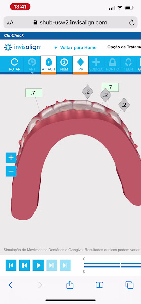 Foto 4 de Dentistas Florianópolis | Invisalign em Florianópolis