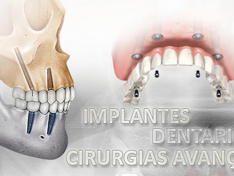 Foto 10 de Dentistas Florianópolis | Invisalign em Florianópolis