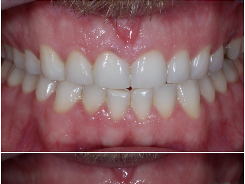 Foto 11 de Dentistas Florianópolis | Invisalign em Florianópolis