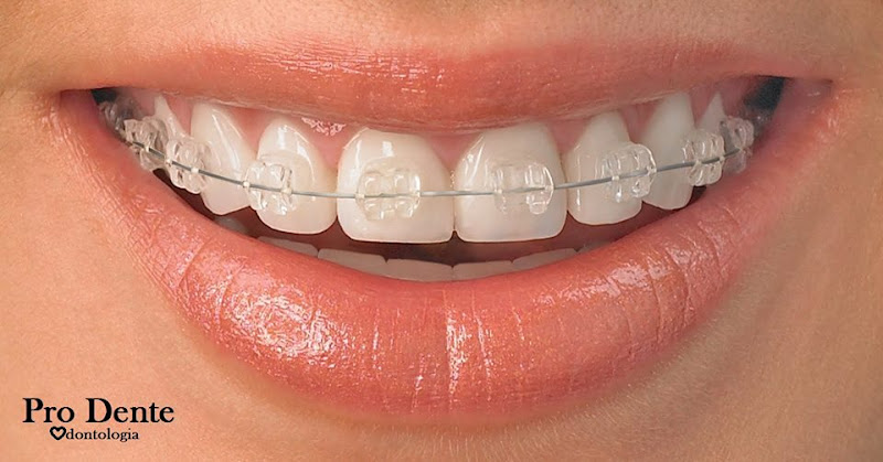 Foto 2 de Dentistas Piracicaba Pro Dente