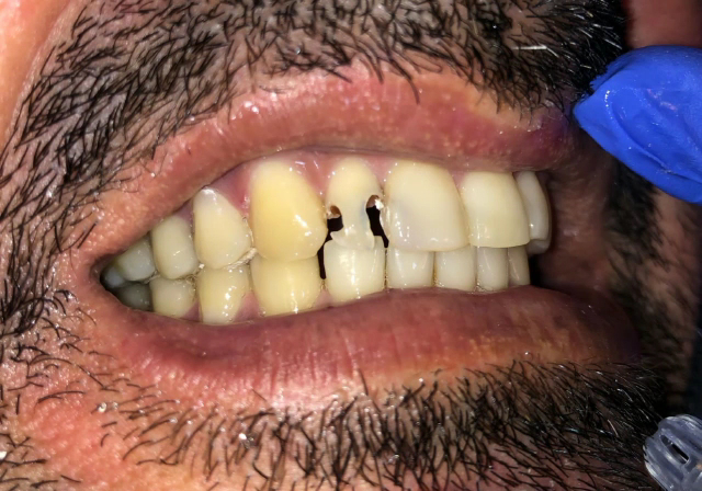 Foto 3 de Dentistas Reconstruindo Sorrisos Jardim América l Canal l Implante l Orto