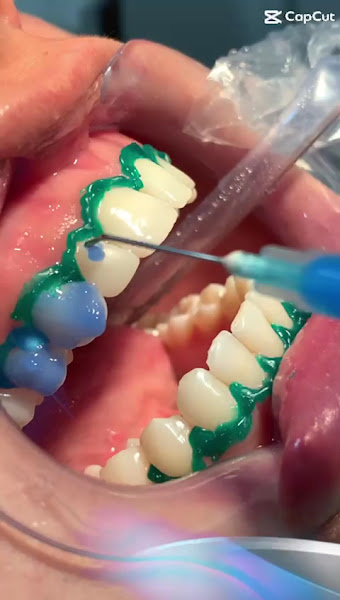Foto 2 de Dentistas Restinga Clínica Odontológica Dentosul
