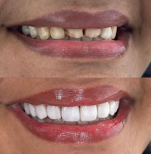 Foto 2 de Dentistas Rinovar Odontologia