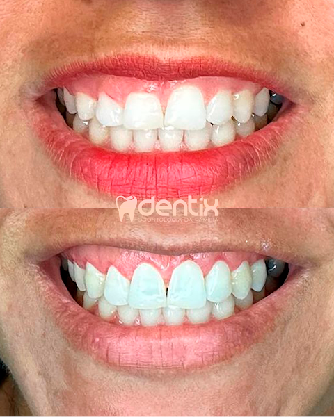 Foto 2 de Dentix Odontologia
